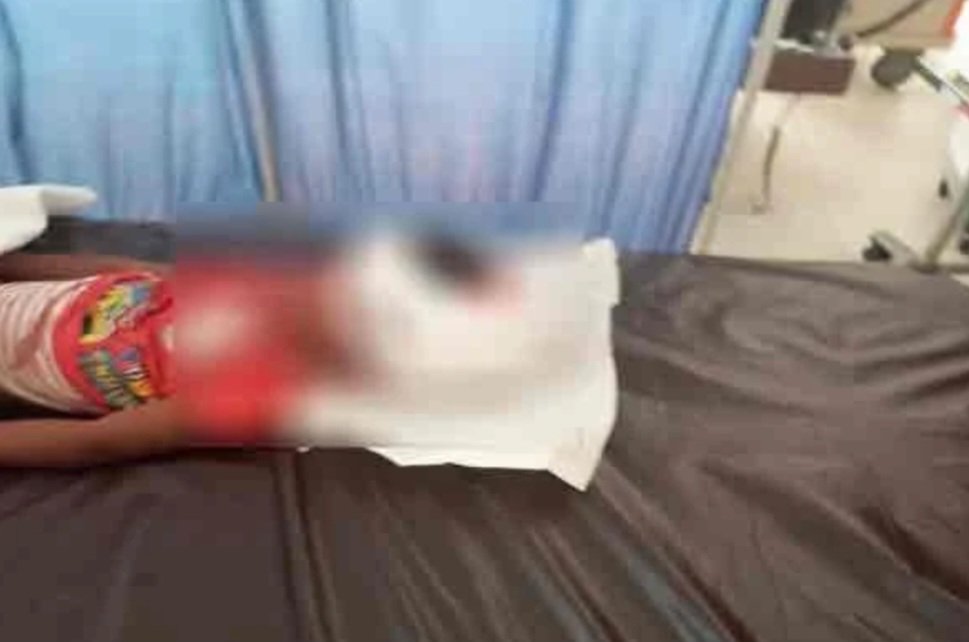 தனியார் ஆடை தொழிற்சாலை பஸ் ஏறி; மூன்று வயது சிறுவன் பரிதாபகரமான முறையில் பலி - மட்டக்களப்பு ஆரையம்பதியில் சம்பவம்.!!! 