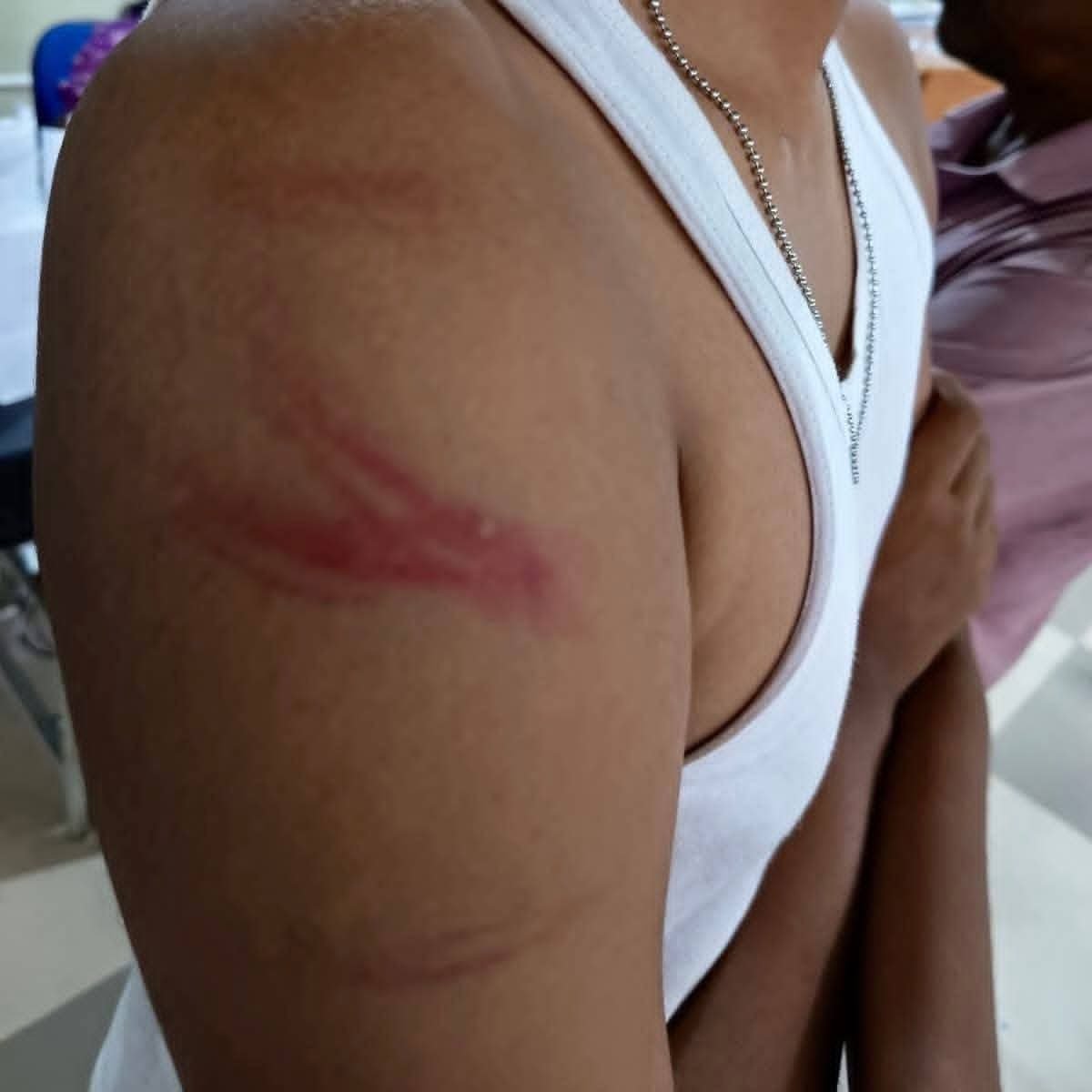 மட்டக்களப்பு பிரபல பாடசாலையில் மாணவன் மீது கொடூர தாக்குதல்: ஆசிரியர்கள் மீது குற்றச்சாட்டு.!!!